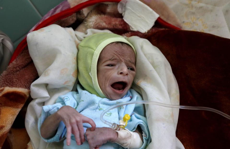 5 وفيات بسبب كورونا مقابل 11 قتيلا في المجاعة كل دقيقة