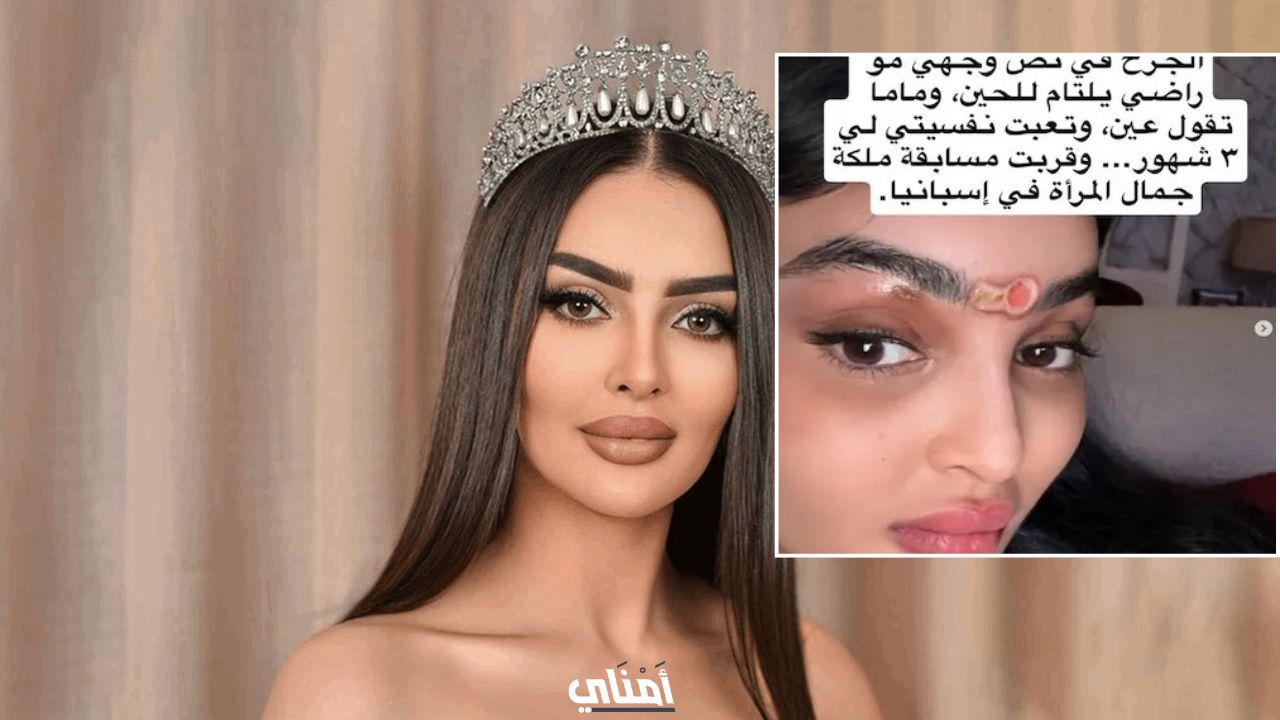 هل السحر سبب تشوه وجه رومي القحطاني؟