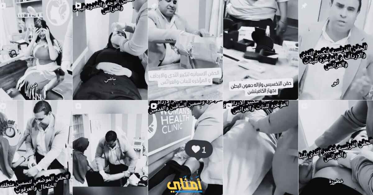 فيديو دكتور التجميل المصري